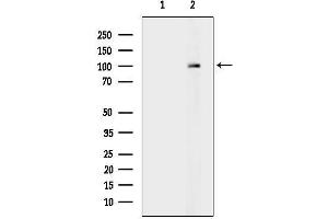 anti-Cap Methyltransferase 1 (CMTR1) antibody