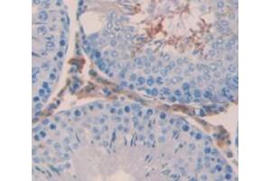 Immunohistochemistry (IHC) image for anti-Catenin, beta (CATNB) (AA 409-665) antibody (ABIN1858530)