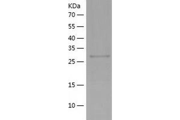 CYB5R1 Protein (AA 29-305) (His tag)