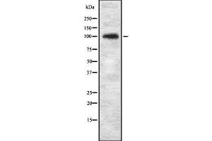 Western blot analysis of KIF20A using LOVO whole cell lysates