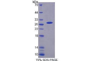 Image no. 1 for Small Ubiquitin Related Modifier Protein 1 (SUMO1) (AA 1-101) protein (His tag) (ABIN6237476)