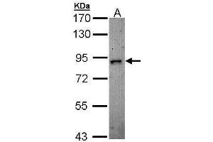 WB Image Sample (30 ug of whole cell lysate) A: H1299 7. (DCLK2 Antikörper)