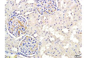 Formalin-fixed and paraffin embedded rat kidney labeled with Anti PNMT Polyclonal Antibody, Unconjugated (ABIN751033) at 1:300 followed by conjugation to the secondary antibody and DAB staining (PNMT Antikörper  (AA 101-200))