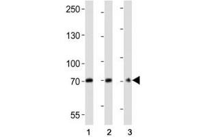 Western blot analysis of lysate from (1) U266, (2) HepG2 cell line, (3) mouse brain tissue lysate using CD73 antibody at 1:2000. (CD73 Antikörper  (AA 520-550))