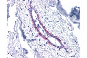 CDH1 antibody was used for immunohistochemistry at a concentration of 4-8 ug/ml. (E-cadherin Antikörper)