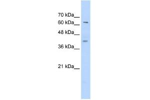 WB Suggested Anti-ZNF415 Antibody Titration:  0. (ZNF415 Antikörper  (C-Term))