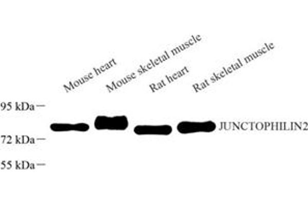 Junctophilin 2 Antikörper