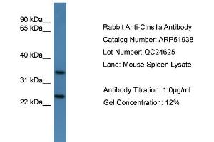 WB Suggested Anti-Clns1a  Antibody Titration: 0. (CLNS1A Antikörper  (C-Term))