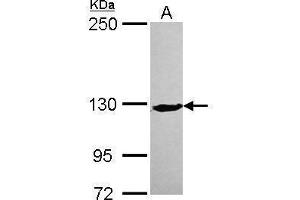 XPC Antikörper  (C-Term)