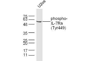 U2os cell lysates probed with Rabbit Anti-IL-7Ra(Tyr449) Polyclonal Antibody, Unconjugated  at 1:500 for 90 min at 37˚C.