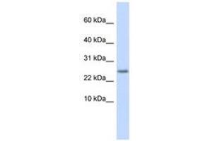 Image no. 1 for anti-Cystatin 9 (Testatin) (CST9) (C-Term) antibody (ABIN6740885) (CST9 Antikörper  (C-Term))