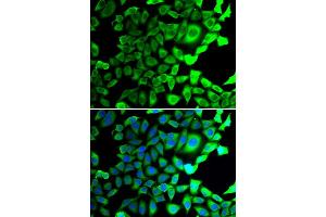 Immunofluorescence analysis of A549 cell using USP8 antibody. (USP8 Antikörper)