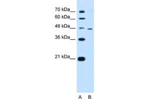 Western Blotting (WB) image for anti-Ring Finger Protein 25 (RNF25) antibody (ABIN2462680)