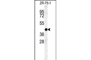 PSG9 Antibody (Center) (ABIN654403 and ABIN2844144) western blot analysis in ZR-75-1 cell line lysates (35 μg/lane).