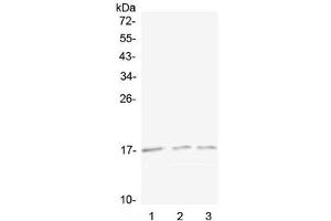 Western blot testing of 1) mouse spleen, 2) mouse kidney and 3) rat kidney lysate with Lymphotactin antibody at 0. (XCL1 Antikörper)