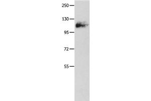 Western Blot analysis of Mouse lung tissue using Amphiphysin I Polyclonal Antibody at dilution of 1:500 (Amphiphysin Antikörper)