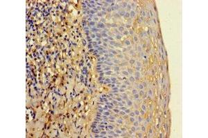 Immunohistochemistry of paraffin-embedded human tonsil tissue using ABIN7142130 at dilution of 1:100 (RNASEL Antikörper  (AA 330-741))