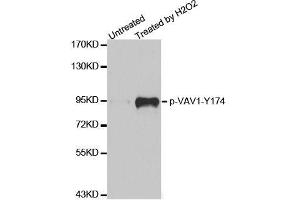 Western blot analysis of extracts from Jurkat cells,using phospho-VAV1-Y174 antibody (ABIN2987533). (VAV1 Antikörper  (pTyr174))