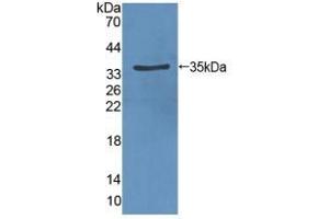 Detection of Recombinant VEGFR2, Rat using Polyclonal Antibody to Vascular Endothelial Growth Factor Receptor 2 (VEGFR2) (VEGFR2/CD309 Antikörper  (AA 46-320))