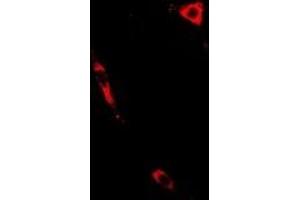 Immunofluorescent analysis of PTGES2 staining in A549 cells. (PTGES2 Antikörper)
