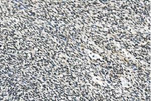 IHC analysis of HOXD11 using anti-HOXD11 antibody (ABIN7603174). (HOXD11 Antikörper  (N-Term))