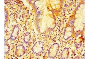 Immunohistochemistry of paraffin-embedded human small intestine tissue using ABIN7152225 at dilution of 1:100 (ECSIT Antikörper  (AA 185-431))