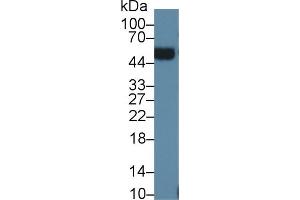 Detection of ORM2 in Human Urine using Polyclonal Antibody to Orosomucoid 2 (ORM2)