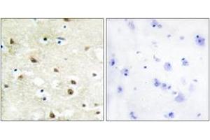 Immunohistochemistry analysis of paraffin-embedded human brain tissue, using hnRNP C1/C2 Antibody.