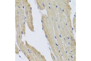 Immunohistochemistry of paraffin-embedded mouse heart using PRPH antibody at dilution of 1:100 (x40 lens).