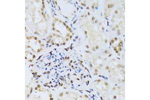 Immunohistochemistry of paraffin-embedded human kidney using MAPK3 Antibody. (ERK1 Antikörper)