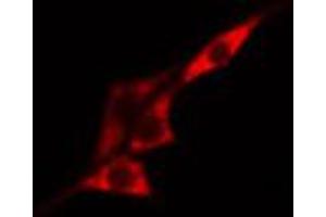 ABIN6267518 staining HeLa cells by IF/ICC. (MTOR Antikörper  (pSer2481))