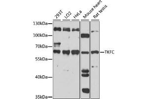 Western blot analysis of extracts of various cell lines, using TKFC antibody (ABIN7266775). (DAK Antikörper  (AA 226-575))