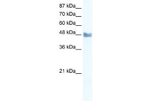 WB Suggested Anti-MAP3K8 Antibody Titration: 2. (MAP3K8 Antikörper  (C-Term))