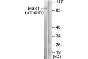Western blot analysis of extracts from RAW264. (MSK1 Antikörper  (pThr581))