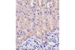 (ABIN654111 and ABIN2843993) staining SLC3A2 in human kidney tissue sections by Immunohistochemistry (IHC-P - paraformaldehyde-fixed, paraffin-embedded sections).