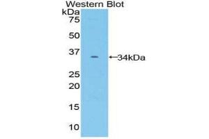Western Blotting (WB) image for anti-Frizzled Family Receptor 10 (FZD10) (AA 235-495) antibody (ABIN1858934) (FZD10 Antikörper  (AA 235-495))