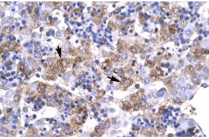 Human Liver; Rabbit Anti-POU1F1 Antibody. (POU1F1 Antikörper  (C-Term))