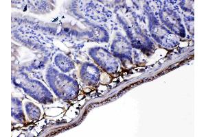 Immunohistochemistry (IHC) image for anti-Periostin (POSTN) (AA 577-810) antibody (ABIN5519054)