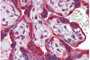 Placenta, Human: Formalin-Fixed, Paraffin-Embedded (FFPE) (Calnexin Antikörper)