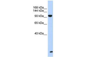 WB Suggested Anti-TNRC6B Antibody Titration:  0. (TNRC6B Antikörper  (N-Term))