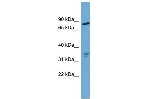 APEH antibody used at 1 ug/ml to detect target protein. (APEH Antikörper  (Middle Region))