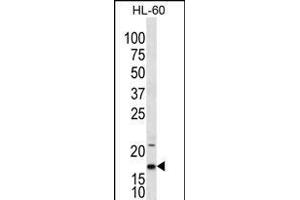 IL1F5 Antibody (N-term) (ABIN656238 and ABIN2845554) western blot analysis in HL-60 cell line lysates (35 μg/lane). (FIL1d Antikörper  (N-Term))