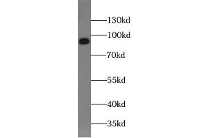 Western blot analysis of HeLa cells subjected to SDS-PAGE, using SUN1 antibody. (SUN1 Antikörper  (AA 4-257))