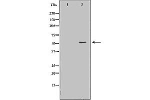 Western blot analysis of extracts of HL60, using FGR antibody. (Fgr Antikörper  (Internal Region))