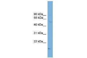 CDS1 antibody used at 0. (CDS1 Antikörper  (N-Term))