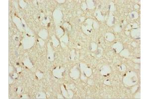 Immunohistochemistry of paraffin-embedded human brain tissue using ABIN7176144 at dilution of 1:100 (ZNF195 Antikörper  (AA 1-250))