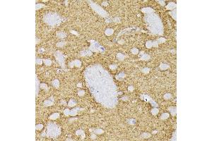 Immunohistochemistry (IHC) image for anti-Synaptophysin (SYP) (AA 150-250) antibody (ABIN6148783)