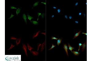 Image no. 4 for anti-Teratocarcinoma-Derived Growth Factor 1 (TDGF1) (N-Term) antibody (ABIN363493) (TDGF1 Antikörper  (N-Term))