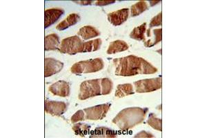 Formalin-fixed and paraffin-embedded human skeletal muscle reacted with CSRP2BP Antibody , which was peroxidase-conjugated to the secondary antibody, followed by DAB staining.