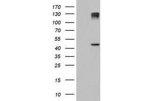 Western Blotting (WB) image for anti-1-Acylglycerol-3-Phosphate O-Acyltransferase 5 (Lysophosphatidic Acid Acyltransferase, Epsilon) (AGPAT5) antibody (ABIN1496500) (AGPAT5 Antikörper)